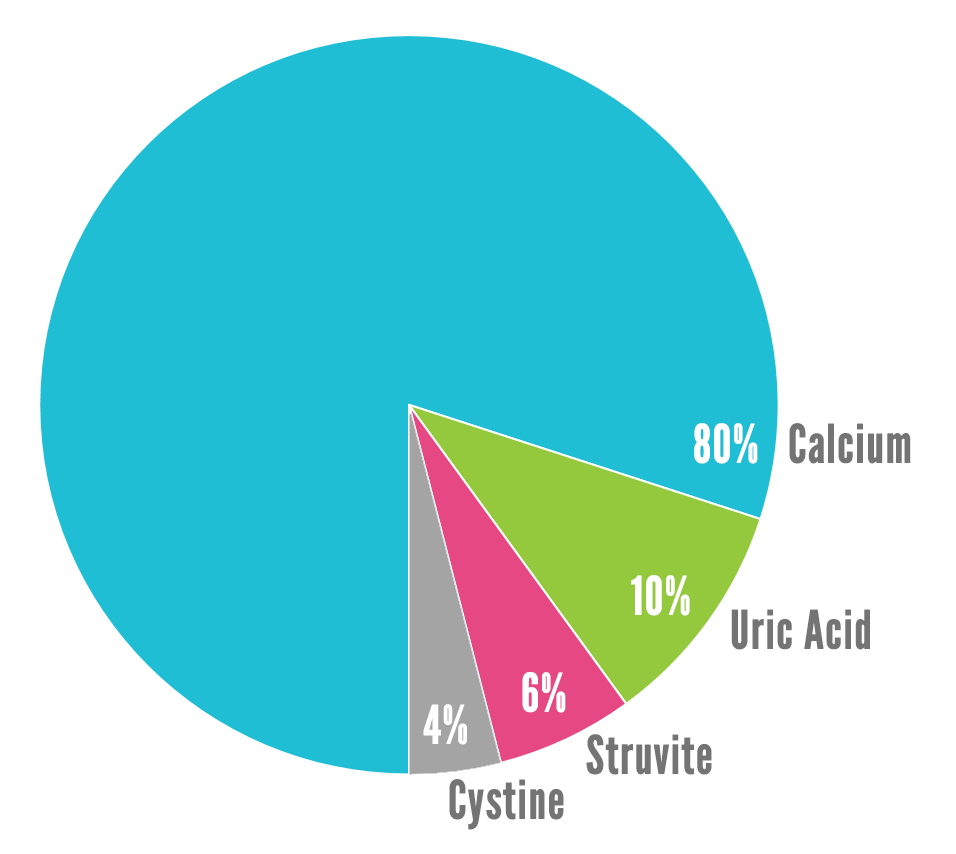 Kidney Stone Chart